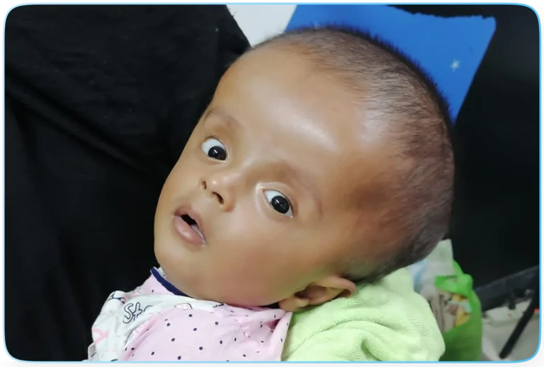 Hydrocephalus Project