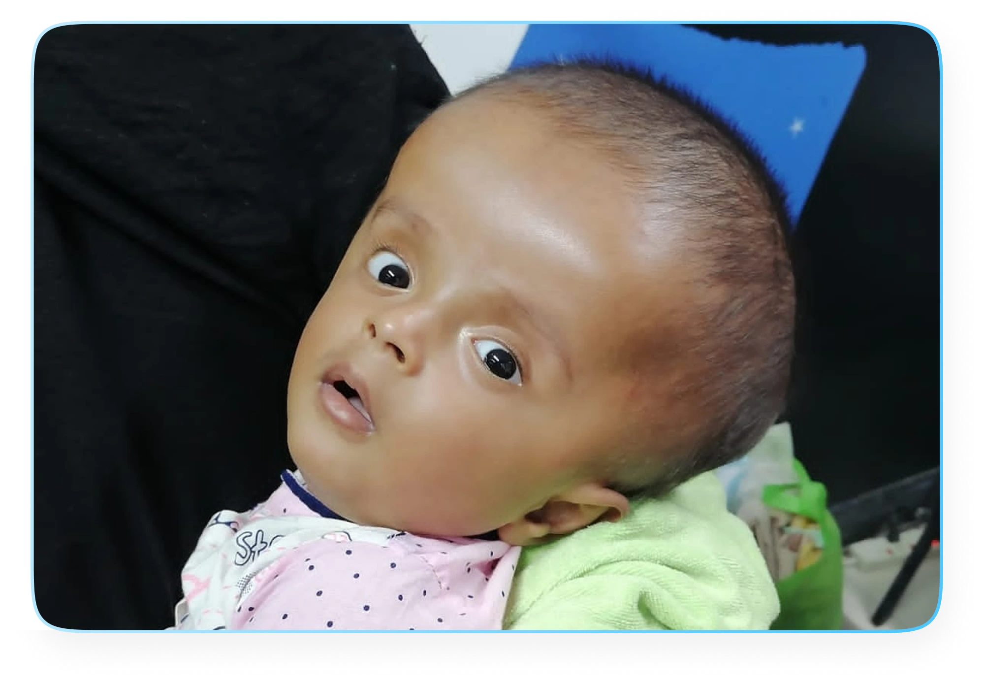 Hydrocephalus Project