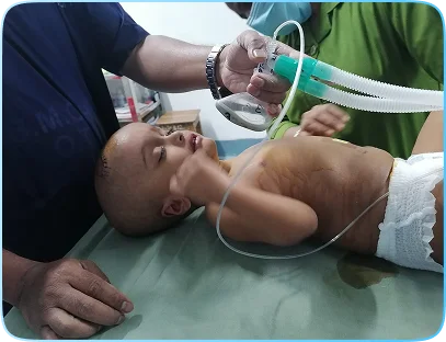 Hydrocephalus3